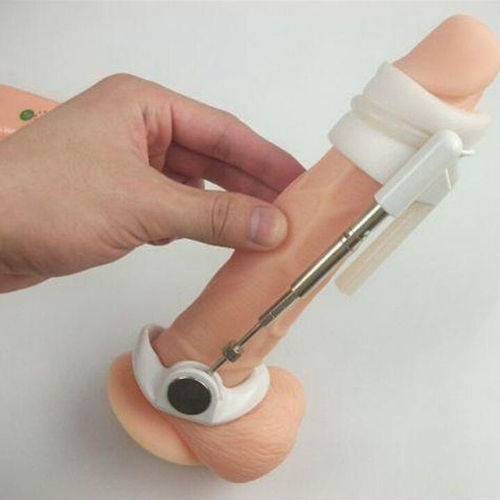 An extender will help increase penis size without creams